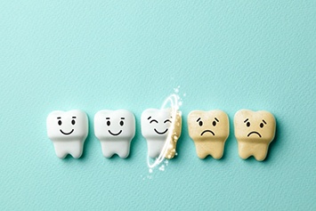 Illustration of teeth whitening in Waco