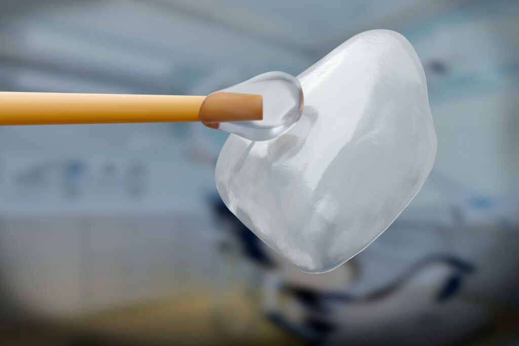 Closeup of dollop of clear glue being applied to veneer